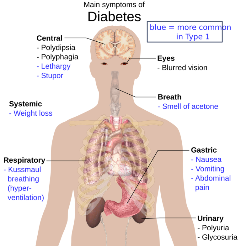 human body anatomy, overview, important symptoms of diabetes-1279964.jpg